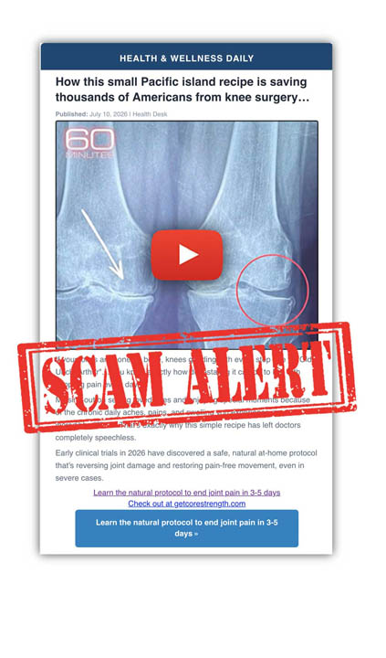 2607-10_KNEE_Pain